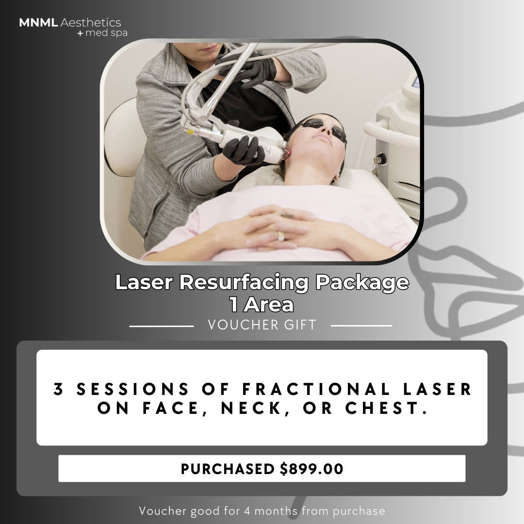 Laser Resurfacing Package - 1 Area Voucher