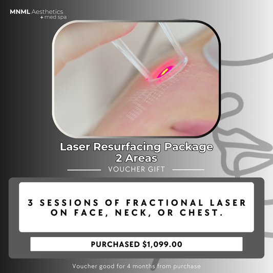 Laser Resurfacing Package - 2 Areas Voucher