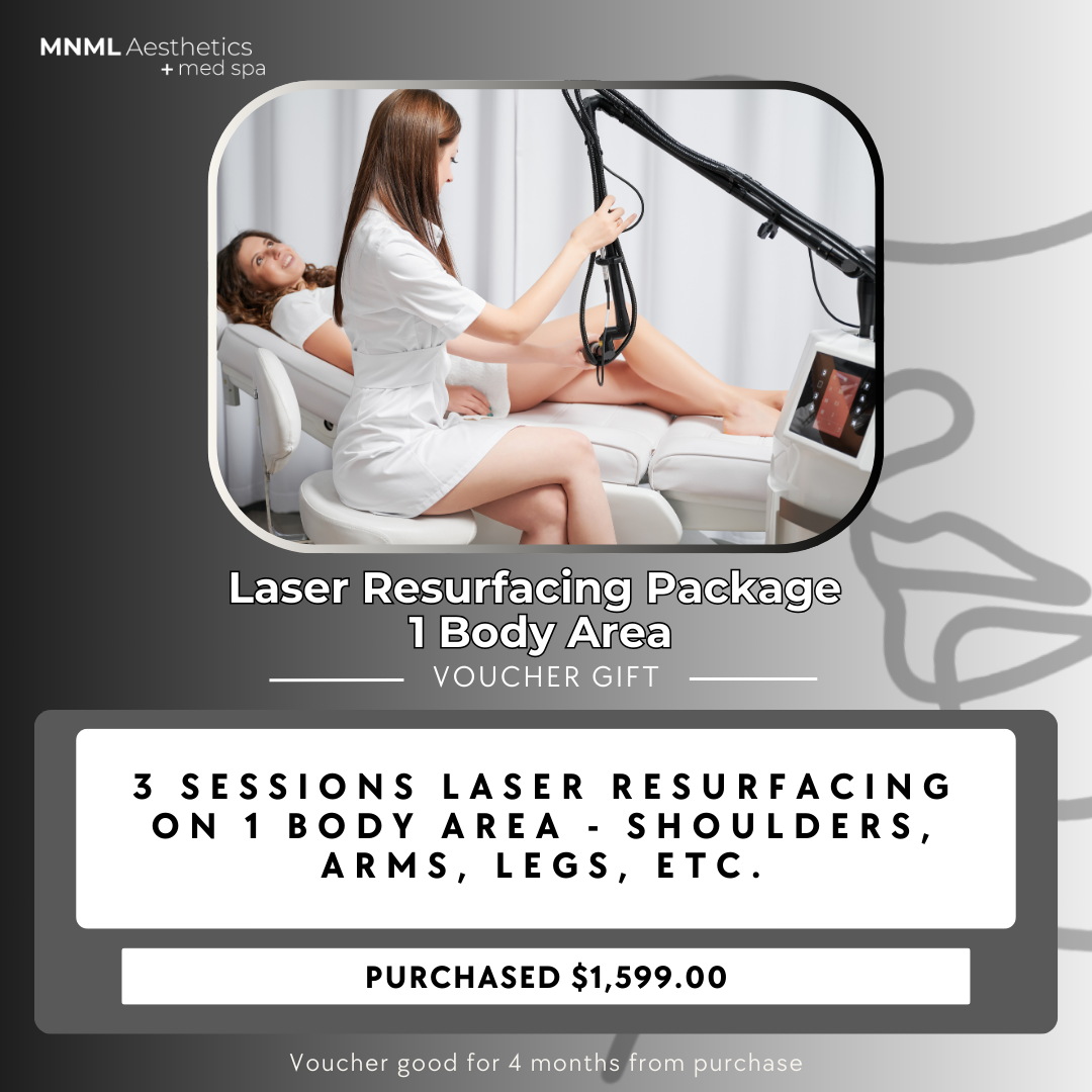 Laser Resurfacing Package - 1 Body Area Voucher