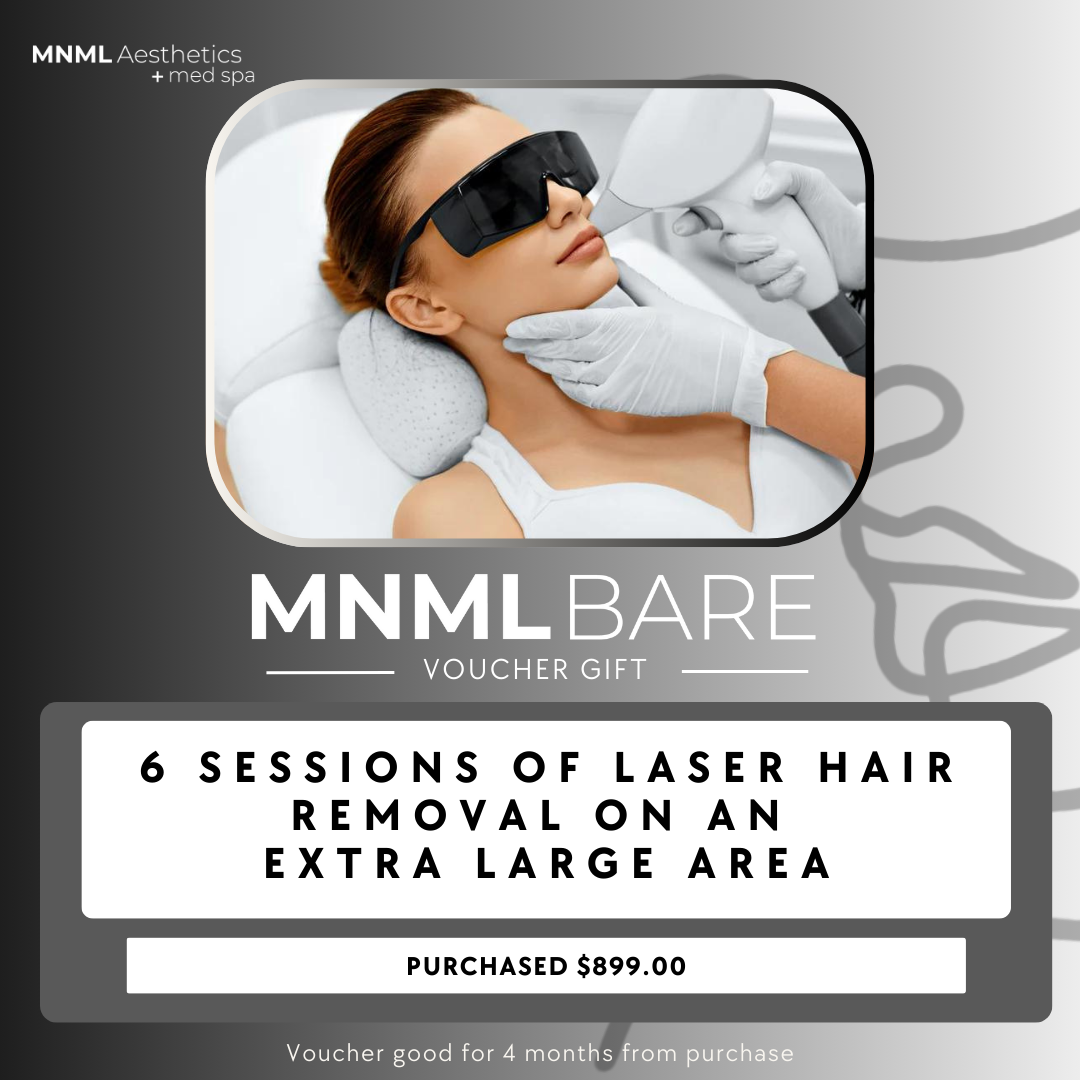 MNML Bare Package - X-Large Area Voucher