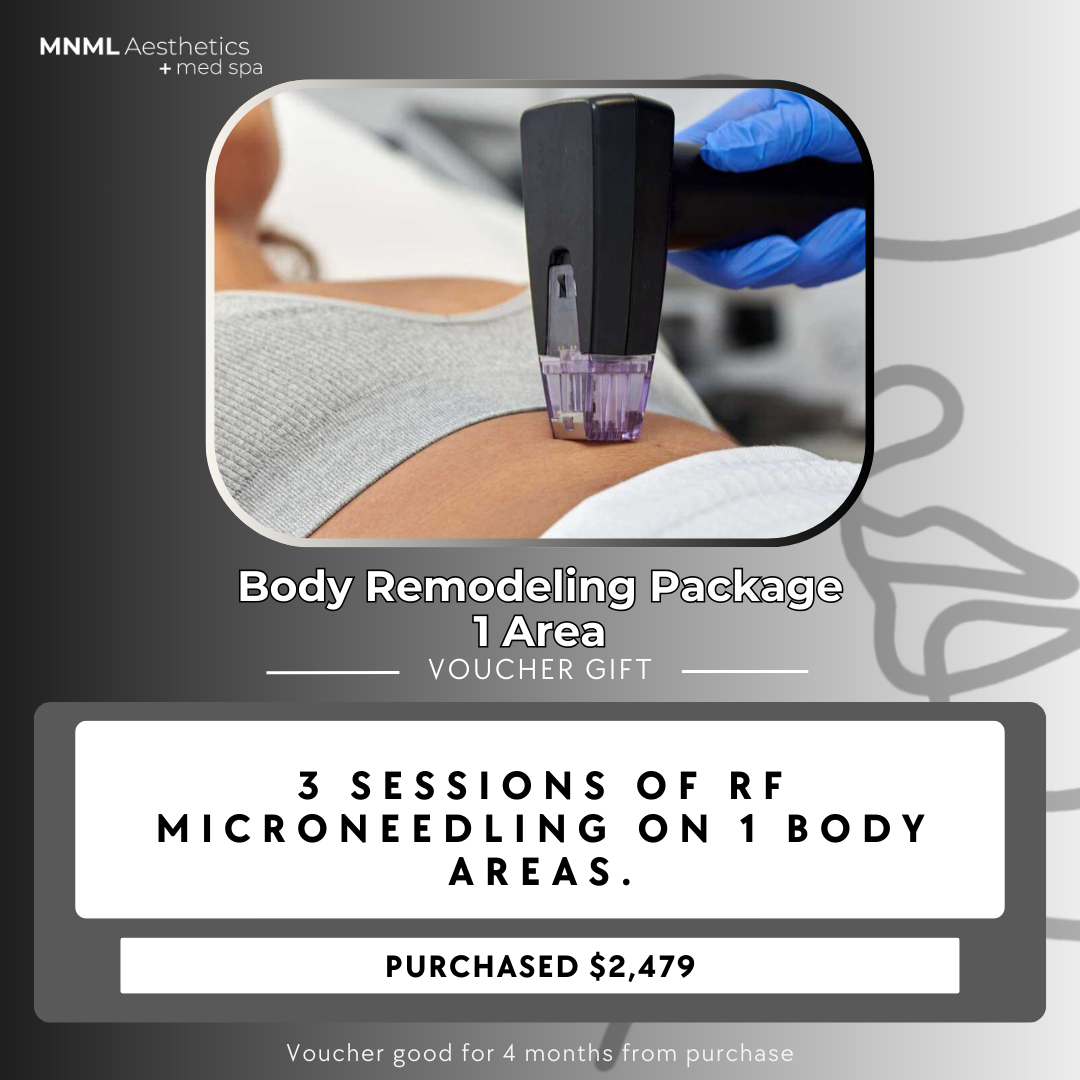 Body Remodeling Package - 1 Area