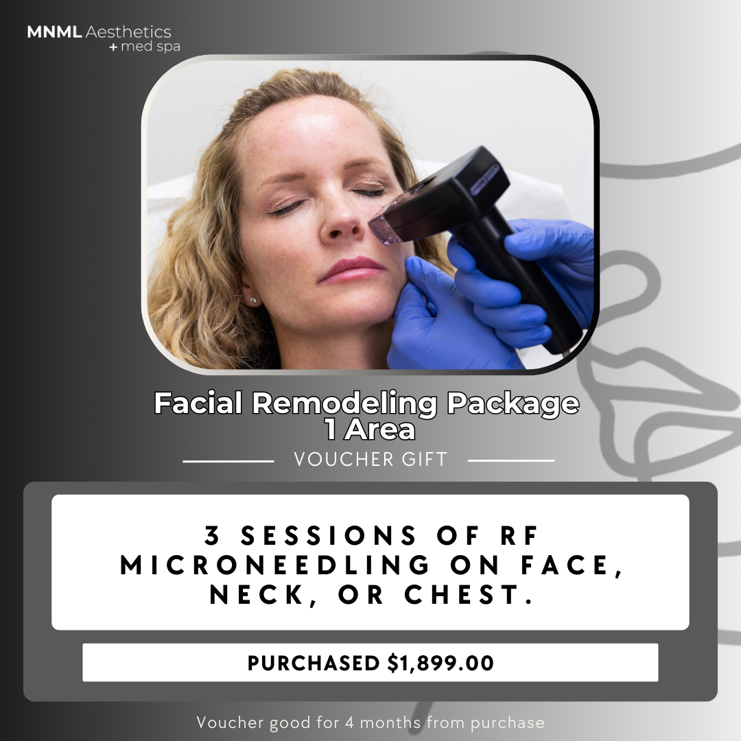 Facial Remodeling Package - 1 Area